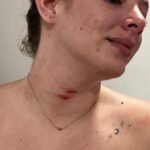 NICOLLE ARAY DENUNCIA INTENTO DE FEMICIO POR PARTE DE SU PAREJA JAVIER LÓPEZ, DIRIGENTE DE LA RC5 EN CHONE