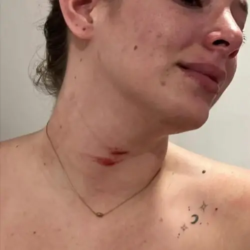 NICOLLE ARAY DENUNCIA INTENTO DE FEMICIO POR PARTE DE SU PAREJA JAVIER LÓPEZ, DIRIGENTE DE LA RC5 EN CHONE